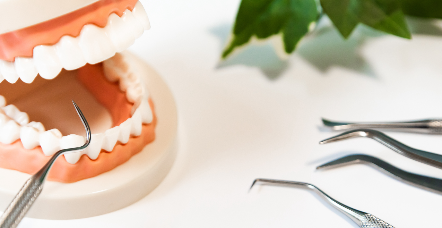 歯科矯正治療の種類